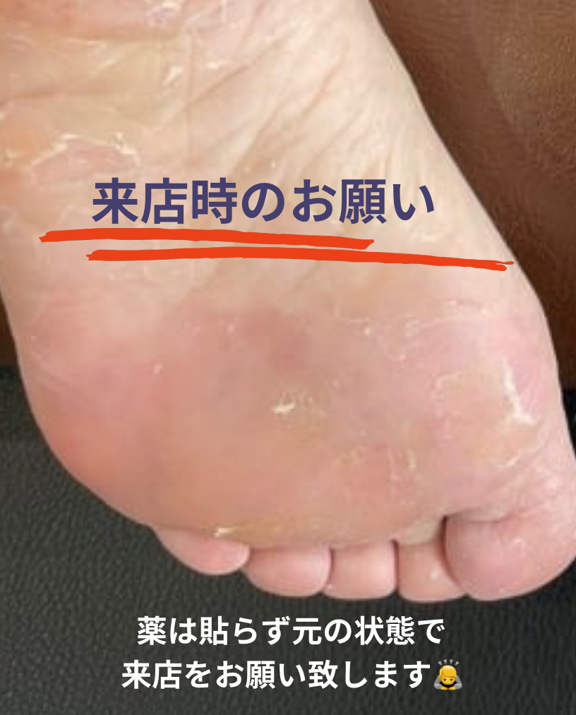 塩井整骨院　タコ